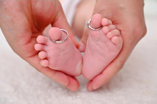 内蒙古怀孕妊娠线不明显